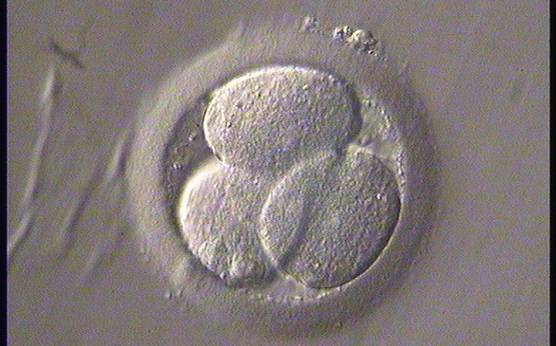 <p><strong>Figure 257</strong></p><p>A 3-cell embryo with three blastomeres of the same size at 26 h after insemination. The blastomeres are not stage-specific cell size.</p>
