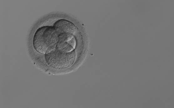 <p><strong>Figure 260</strong></p><p>A 5-cell embryo with four large and one small blastomeres instead of three large and two small blastomeres; therefore, not stage-specific cell size.</p>
