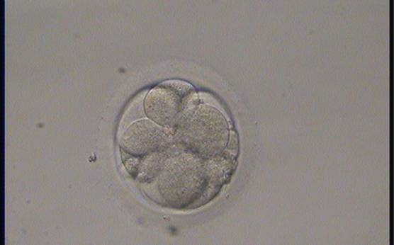 <p><strong>Figure 263</strong></p><p>A 7-cell embryo with three large and four small blastomeres instead of one large and six small blastomeres; therefore, not stage-specific cell size. One blastomere shows multinucleation.</p>