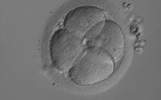 <p><strong>Figure 264</strong></p><p>A 4-cell embryo with equally sized, mononucleated blastomeres arranged in a clover shape on Day 2 post-injection. There is a single nucleus clearly visible in each blastomere.</p>