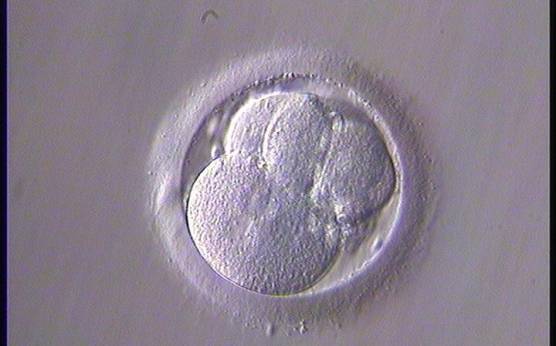 <p><strong>Figure 267</strong></p><p>A 4-cell embryo with blastomeres of unequal size and with one binucleated blastomere. The embryo was transferred but failed to implant.</p>