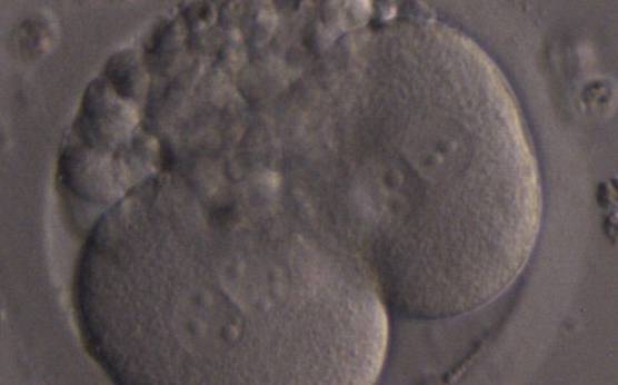 <p><strong>Figure 269</strong></p><p>A 2-cell embryo with two binucleated blastomeres and 25–30% fragmentation.</p>
