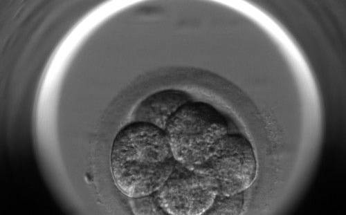 <p><strong>Figure 271</strong></p><p>An 8-cell embryo with equally sized blastomeres showing cytoplasmic pitting. Numerous small pits are present on the surface of the cytoplasm.</p>