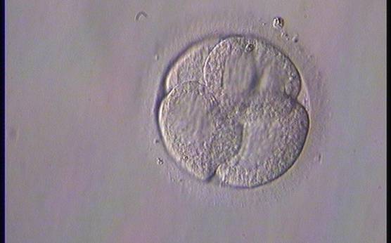 <p><strong>Figure 274</strong></p><p>A 4-cell embryo on Day 2 with an abnormal distribution of organelles leading to differential granular and smooth zones inside each cell.</p>