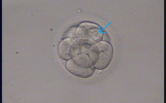 <p><strong>Figure 275</strong></p><p>An 8-cell embryo with one blastomere showing a small vacuole (arrow).</p>