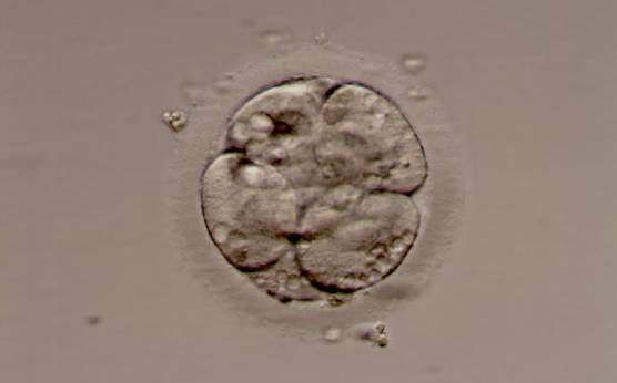<p><strong>Figure 277</strong></p><p>An embryo with abundant small vacuoles.</p>
