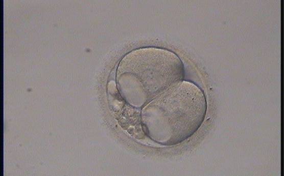 <p><strong>Figure 278</strong></p><p>A 2-cell embryo with large vacuoles in both blastomeres and 15% concentrated fragmentation.</p>