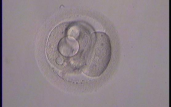 <p><strong>Figure 280</strong></p><p>A 3-cell embryo with different sized blastomeress showing both large and small vacuoles.</p>