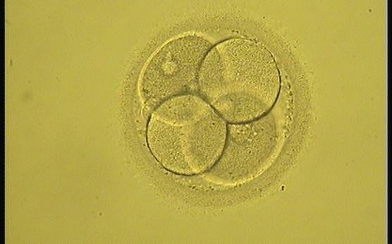 <p><strong>Figure 281</strong></p><p>A 4-cell embryo with a typical pyramidal or tetrahedral structure. The embryo was generated by IVF and was transferred and implanted.</p>
