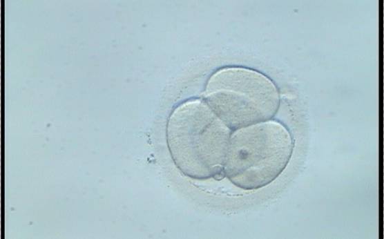 <p><strong>Figure 282</strong></p><p>A 4-cell embryo with a typical pyramidal or tetrahedral structure. The embryo was generated by IVF and was transferred but failed to implant.</p>