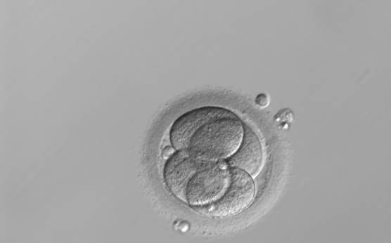 <p><strong>Figure 283</strong></p><p>A 4-cell embryo with a non-tetrahedral or clover structure. It was generated by ICSI and was cryopreserved.</p>
