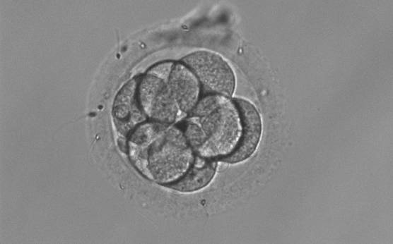 <p><strong>Figure 291</strong></p><p>An 8-cell embryo that shows no signs of compaction. Cells are evenly sized and barely touching.</p>