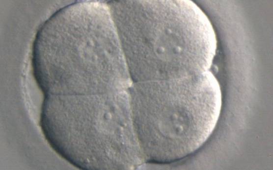 <p><strong>Figure 294</strong></p><p>A clover shaped 4-cell embryo showing signs of very early compaction. A single nucleus is clearly visible in each cell.</p>