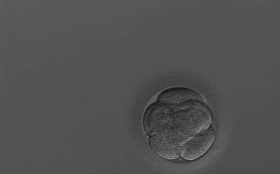 <p><strong>Figure 295</strong></p><p>A 7-cell embryo showing signs of early compaction. This embryo was transferred but failed to implant.</p>