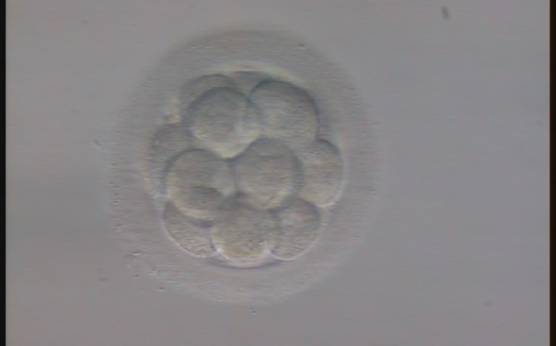 <p><strong>Figure 296</strong></p><p>An embryo with more than 12 blastomeres showing no signs of compaction. With this number of cells it is very unusual that the embryo has not yet initiated compaction.</p>