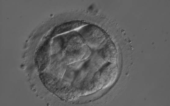 <p><strong>Figure 301</strong></p><p>Embryo showing early cavitation with an initial blastocoele cavity beginning to appear.</p>