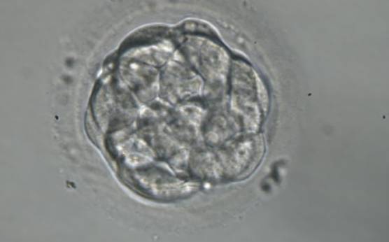 <p><strong>Figure 303</strong></p><p>A very early blastocyst with a small cavity appearing centrally. The blastocyst was transferred but the outcome is unknown.</p>