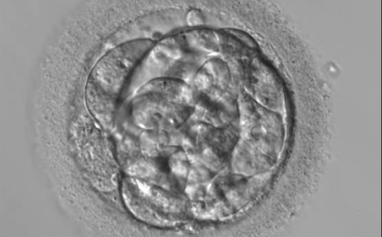 <p><strong>Figure 305</strong></p><p>A very early blastocyst with a small cavity appearing centrally and can be seen most obviously at the 12 o'clock position in this view. Note the cellular debris that is not incorporated into the early blastocyst formation that has been sequestered to the perivitelline space (PVS).</p>