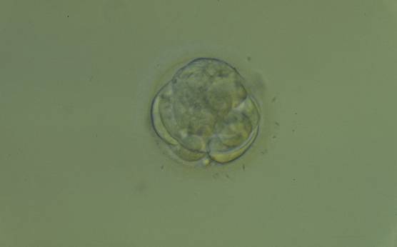<p><strong>Figure 308</strong></p><p>An early blastocyst with a cavity beginning to be formed centrally. Note the early formation of the flattened TE cells which at this stage are large, with two cells stretching to line the cavity from the 9 o'clock to the 3 o'clock position in this view. The blastocyst was transferred but failed to implant.</p>