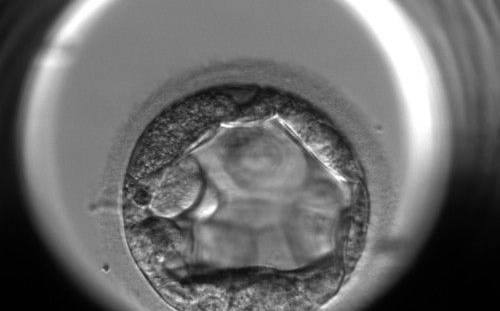 <p><strong>Figure 311</strong></p><p>An early blastocyst with the cavity occupying >50% of the volume of the embryo. The TE cells are very large at this stage.</p>
