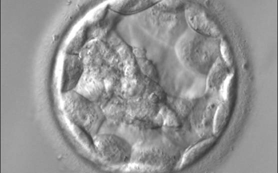 <p><strong>Figure 312</strong></p><p>An early blastocyst with the cavity occupying >50% of the volume of the embryo. The overall volume of the blastocyst remains unchanged with no thinning of the ZP. The early ICM can be seen on the left half of the blastocyst in this view. The blastocyst was transferred and implanted.</p>