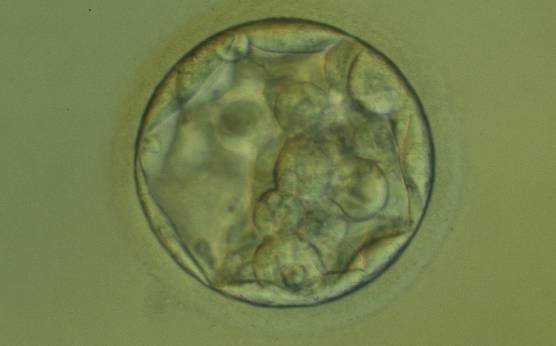 <p><strong>Figure 313</strong></p><p>An early blastocyst with the cavity occupying >50% of the volume of the embryo. The overall volume of the blastocyst remains unchanged with no thinning of the ZP. The early ICM can be seen at the base of the blastocyst in this view. The blastocyst was transferred but failed to implant.</p>