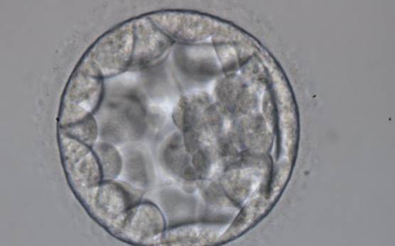 <p><strong>Figure 315</strong></p><p>Blastocyst (Grade 3:2:1) showing a cavity occupying the total volume of the embryo. The ICM can be seen at the 3 o′clock position in this view and is loosely made up of only a few cells. The blastocyst was transferred but the outcome is unknown.</p>