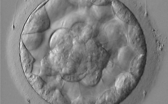 <p><strong>Figure 317</strong></p><p>Blastocyst (Grade 3:1:1) showing a compact ICM at the base of the blastocyst in this view. The blastocyst was transferred and resulted in the delivery of a healthy boy.</p>