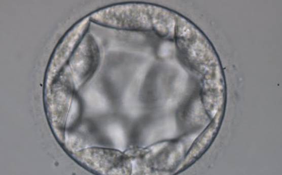 <p><strong>Figure 318</strong></p><p>Blastocyst (Grade 3:3:2) with no clearly identifiable ICM and TE cells that in places are quite large and stretch over great distances to reach the next cell.</p>
