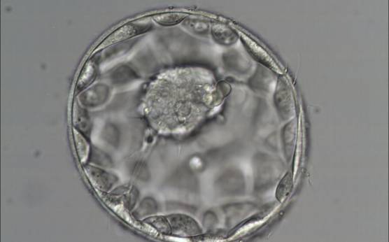 <p><strong>Figure 321</strong></p><p>Good quality expanded blastocyst (Grade 4:1:1) with a large mushroom-shaped ICM. The blastocyst is now a greater volume than the original volume of the embryo and the ZP is thinned. There appears to be cytoplasmic strings extending from the ICM to the TE. The blastocyst was transferred and implanted.</p>