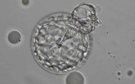 <p><strong>Figure 327</strong></p><p>Hatching blastocyst (Grade 5:2:1) showing a small triangular ICM being drawn out along with the herniating TE cells at the 1 o'clock position in this view. There are very many TE cells of similar size lining the blastocoel cavity and the ZP is thinned. The blastocyst was transferred but the outcome is unknown.</p>