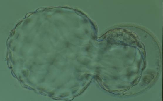 <p><strong>Figure 329</strong></p><p>Hatching blastocyst (Grade 5:1:1) showing a large, compact, crescent-shaped ICM retained within the ZP at the 12 o'clock position in this view. There are very many TE cells and almost 75% of the blastocyst has herniated out through a breach in the ZP at the 8–10 o'clock positions in this view. The blastocyst was transferred but the outcome is unknown.</p>