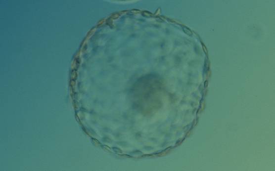 <p><strong>Figure 333</strong></p><p>Hatched blastocyst (Grade 6:1:1) that is now completely free of the ZP. There is a large, compact ICM slightly out of focus at the base of the blastocyst toward the 4 o'clock position in this view. The blastocyst is now more than twice the size of the original expanded blastocyst. The blastocyst was transferred but failed to implant.</p>