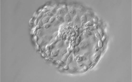<p><strong>Figure 335</strong></p><p>Hatched blastocyst (Grade 6:1:1) that is now completely free of the ZP. The ICM positioned centrally at the base of the blastocyst appears to be connected or anchored to the TE by several bridges. There are very many TE cells of similar size forming a cohesive epithelium. The blastocyst is now more than twice the size of the original expanded blastocyst.</p>
