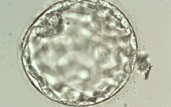 <p><strong>Figure 346</strong></p><p>Blastocyst (Grade 3:2:1) showing a compact ICM at the 11 o'clock position in this view. The ICM is small relative to the diameter of the blastocyst and probably made up of few cells. The blastocyst was transferred but failed to implant.</p>