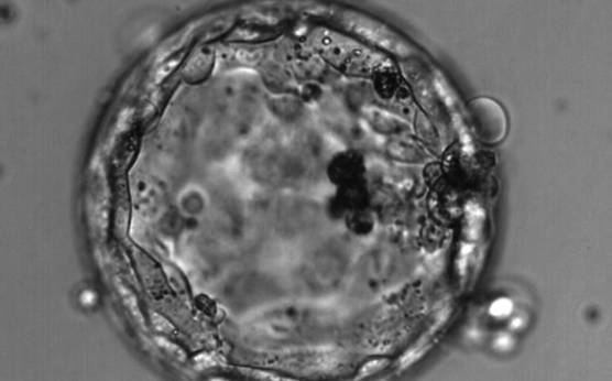 <p><strong>Figure 353</strong></p><p>Hatching blastocyst (Grade 4:3:1) with no clearly identifiable ICM but a TE that is made up of many cells forming a cohesive epithelium. Dark, degenerate cells are present toward the 3 o′clock position in this view.</p>