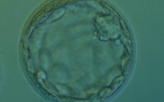 <p><strong>Figure 355</strong></p><p>Expanded blastocyst (Grade 4:2:1) with a small, mushroom-shaped compact ICM. There is some cellular debris present in the space between the ZP and the TE at the 10–12 o'clock positions. The blastocyst was transferred but the outcome is unknown.</p>
