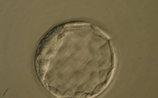 <p><strong>Figure 362</strong></p><p>Blastocyst (Grade 3:1:1) with a crescent-shaped ICM at the 10 o'clock position in this view. The blastocyst was transferred but the outcome is unknown.</p>