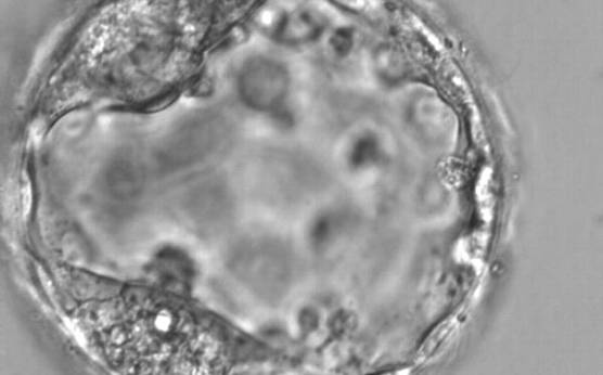 <p><strong>Figure 363</strong></p><p>Expanded blastocyst (Grade 4:1:1) with two distinct ICMs at the 7 and 11 o'clock positions in this view. Both ICMs are of reasonable size and compact.</p>