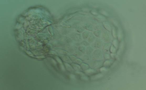 <p><strong>Figure 367</strong></p><p>Hatching blastocyst (Grade 5:1:1) with many cells making up a cohesive TE. The ICM is herniating through a breach in the ZP at the 10 o′clock position in this view. The blastocyst was transferred but failed to implant.</p>