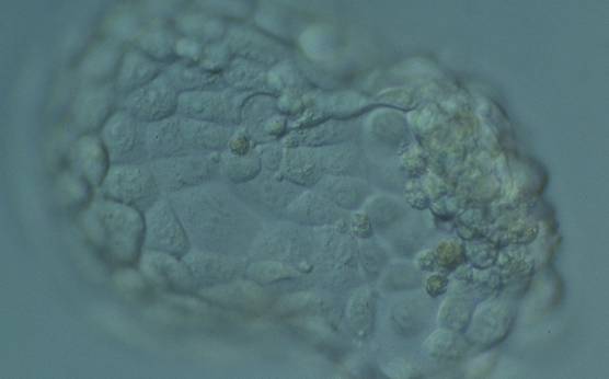 <p><strong>Figure 368</strong></p><p>Hatching blastocyst (Grade 5:1:1) with many cells, some of variable size, making up a cohesive epithelium. The blastocyst was transferred but failed to implant.</p>