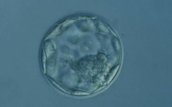 <p><strong>Figure 372</strong></p><p>Expanded blastocyst (Grade 4:1:2). The TE cells vary in size with some cells quite large being particularly evident at the edge of the blastocyst where the cells stretch over some distance to reach their nearest neighbors. The blastocyst was transferred but the outcome is unknown.</p>