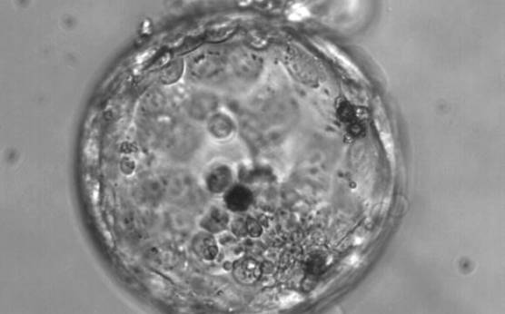 <p><strong>Figure 376</strong></p><p>Hatching blastocyst (Grade 5:3:3). The TE varies in size and does not form a cohesive epithelium. Several loosely cohesive ICM cells can be seen at the 5 o'clock position in this view. There are several dark degenerate foci within the blastocyst.</p>