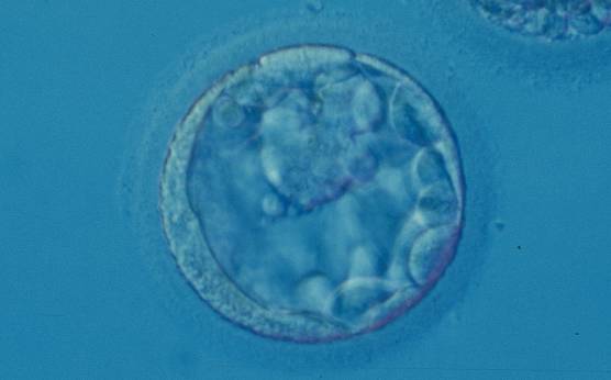 <p><strong>Figure 383</strong></p><p>Blastocyst (Grade 3:1:2) with a large, mushroom-shaped ICM toward the 1 o'clock position in this view. From the 6 o'clock to the 3 o'clock position there is a significant amount of cellular debris, both large and small, between the mural TE and the ZP.</p>