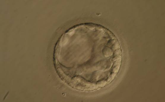 <p><strong>Figure 394</strong></p><p>Early blastocyst (Grade 2) with large vacuolization of the TE distinct from the blastocoel cavity at the 10 o'clock position in this view. The blastocyst was transferred but the outcome is unknown.</p>