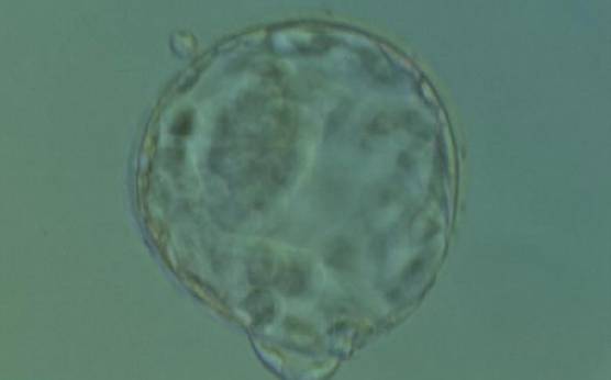 <p><strong>Figure 397</strong></p><p>Hatching blastocyst (Grade 5:1:1) with two distinct points of natural hatching, one at the 11 o'clock and one at the 6 o'clock position. The ICM is large and compact and the TE cells are many and form a cohesive epithelium. There is a significant difference in the diameter of the two breaches in the ZP. The blastocyst developed following standard insemination and so the smaller diameter breach is not a result of sperm injection. The blastocyst was transferred but failed to implant.</p>