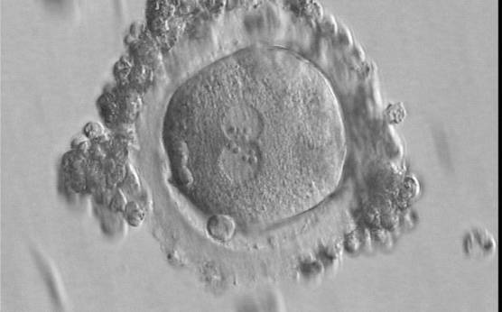 <p><strong>Figure 86</strong></p>

<p>A slightly deformed zygote at 16.5 h after IVF with equal numbers of large-sized NPBs aligned at the PN junction (400× magnification). A great angle separates the two polar bodies. Some granulosa cells surround the ZP. It was transferred but failed to implant.</p>