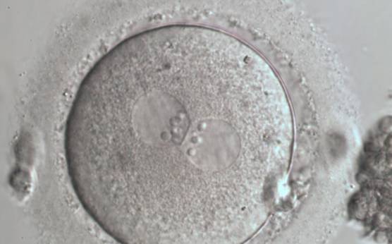<p><strong>Figure 88</strong></p>

<p>A zygote generated by ICSI with NPBs perfectly aligned at the junction of centrally located and juxtaposed PNs (600× magnification). Fragmented polar bodies are located in the longitudinal axis of the PNs. Category 1 (equivalent to Z1 score; Scott, 2003) was assigned following assessment. Debris appears to be present in the PVS. The cytoplasm is light-coloured with a clear cortical zone. It was transferred and implanted.</p>