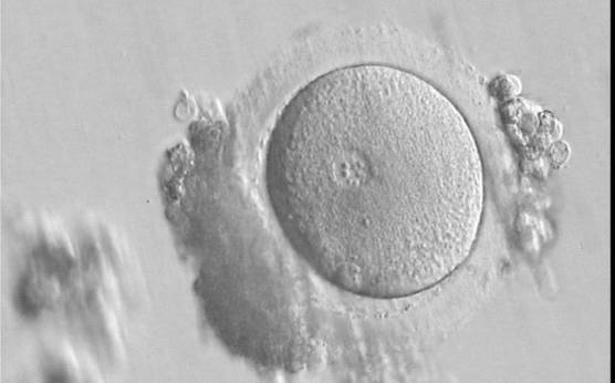 <p><strong>Figure 91</strong></p>

<p>A zygote 17 h post-IVF showing a single PN with NPBs of different size and two polar bodies (400× magnification).</p>