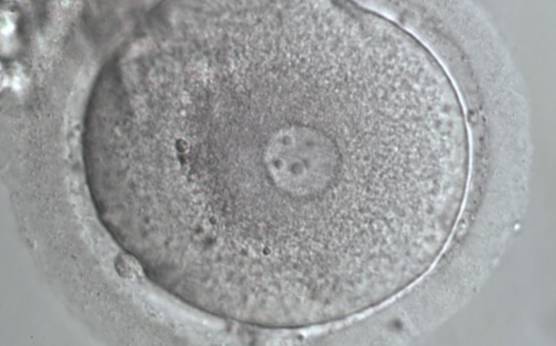 <p><strong>Figure 93</strong></p>

<p>A zygote generated by ICSI showing a single PN and two polar bodies separated by some distance (600× magnification).</p>